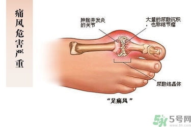 痛風可以吃木耳嗎?痛風不能吃什么