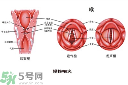 慢性咽炎是什么？慢性咽炎的癥狀有哪些？