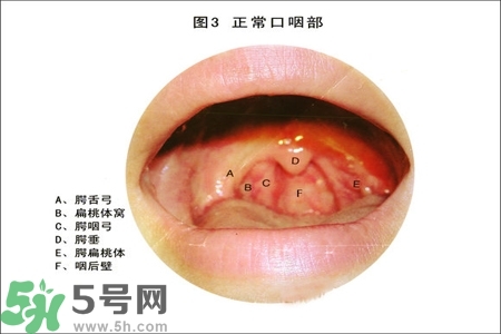 慢性咽炎的治療方法？慢性咽炎的藥物治療？