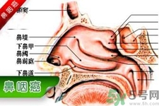 鼻咽癌是什么？鼻咽癌的癥狀有哪些？