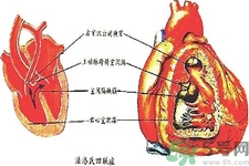 先天性心臟病可以用藥物治療嗎？