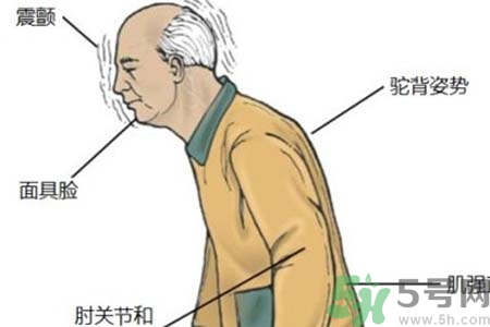 帕金森的易發(fā)人群有哪些？如何預(yù)防帕金森？