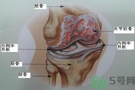 預(yù)防骨病需要注意哪些姿勢？秋季預(yù)防骨病的方法有哪些？