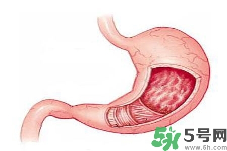 急性腸胃炎哪些食物不可以吃？急性腸胃炎不能吃的水果有？