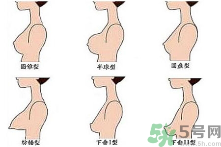 ?女性乳房下垂的原因是什么？女性乳房下垂的分類有哪些？