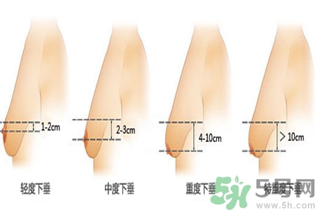 胸部松弛的原因是什么？胸部松弛該怎么辦？