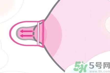 乳頭內(nèi)陷能不能喂奶？乳頭凹陷怎樣哺乳？