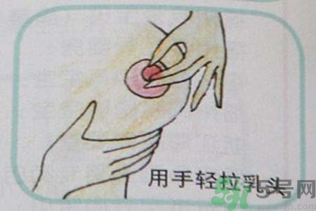 乳頭內(nèi)陷可以拔罐嗎？乳頭內(nèi)陷需要手術(shù)治療嗎？