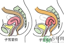 ?子宮移位怎么治療？子宮移位能懷孕嗎？