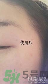 dr.jart適合什么年齡層？蒂佳婷適合年齡