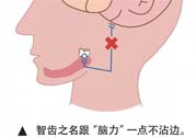 長(zhǎng)智齒疼痛怎么辦？長(zhǎng)智齒牙齦腫了怎么辦？