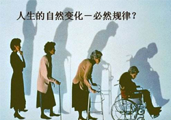 哪些人容易得骨質(zhì)疏松癥？骨質(zhì)疏松的高發(fā)人群有哪些？