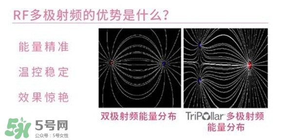 tripollar stop怎么樣？tripollar pose好用嗎