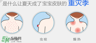 妙思樂爽膚水好用嗎？妙思樂爽膚水能去痱嗎？