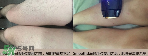 smoothskin和slikn infinity哪個好？smoothskin脫毛儀怎么樣