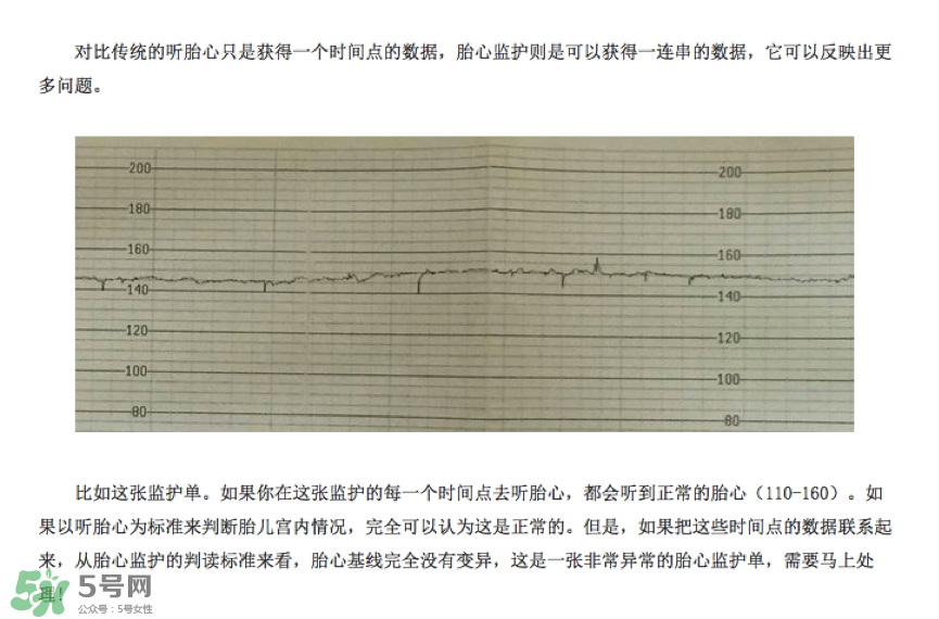 胎心儀有必要買(mǎi)嗎？胎心儀是不是必需品？