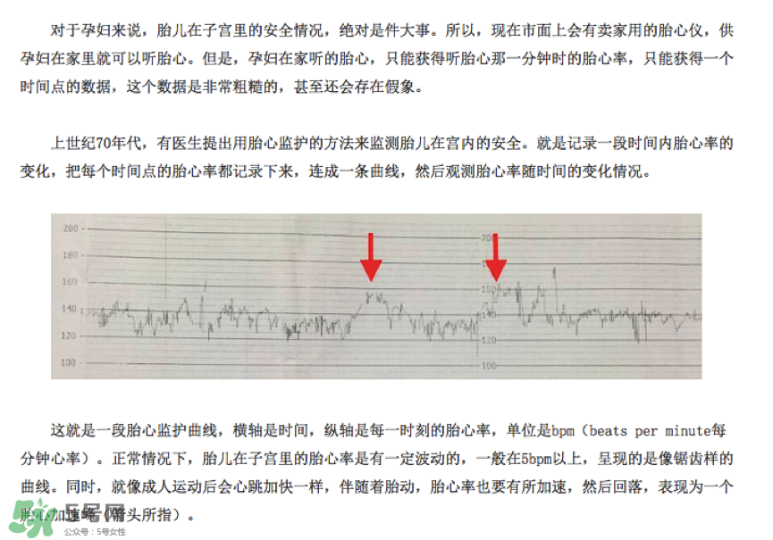 胎心儀有必要買(mǎi)嗎？胎心儀是不是必需品？