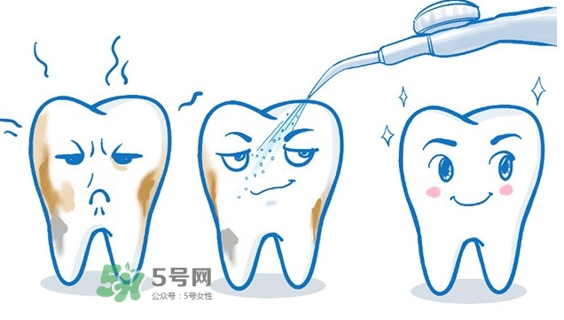 洗牙多少錢一次 洗牙多久洗一次比較好