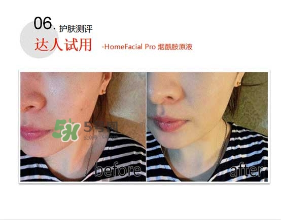 homefacialpro煙酰胺原液怎么樣？hfp煙酰胺原液好用嗎