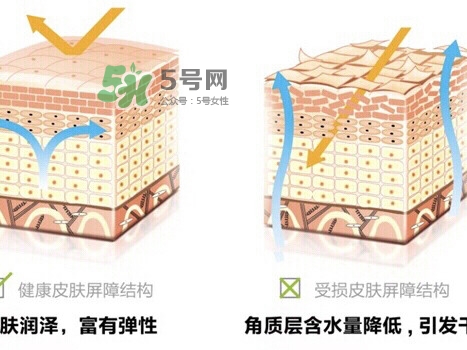 肌膚屏障受損的原因是什么 肌膚屏障受損用什么護膚品