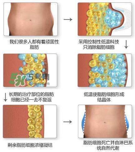 酷塑溶脂效果對(duì)比圖片 酷塑溶脂全過(guò)程記錄