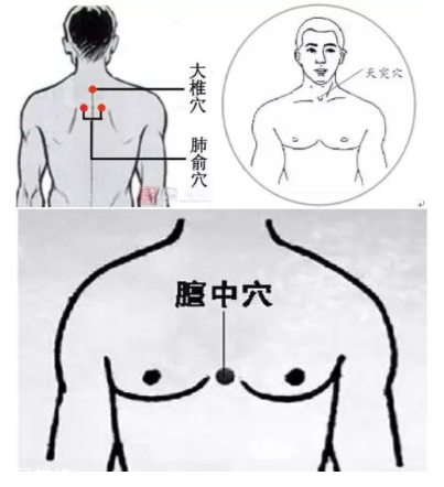 吮痧有什么療效？最溫柔的治病方法