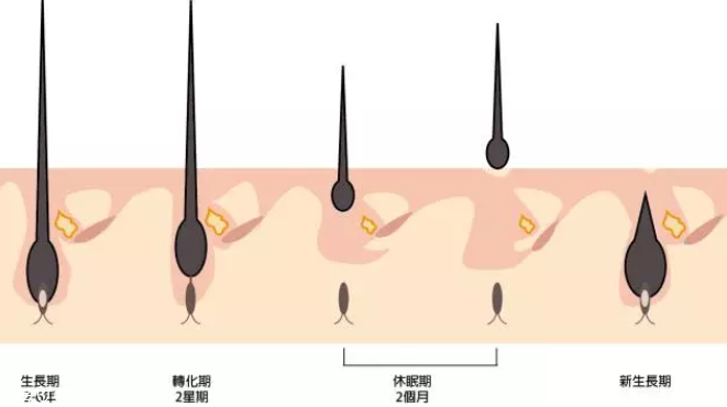 頭發(fā)為什么會(huì)掉？毛囊想休息了