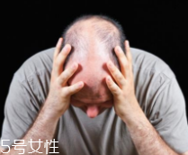 脫發(fā)有沒有治？只要不是禿子就有得治