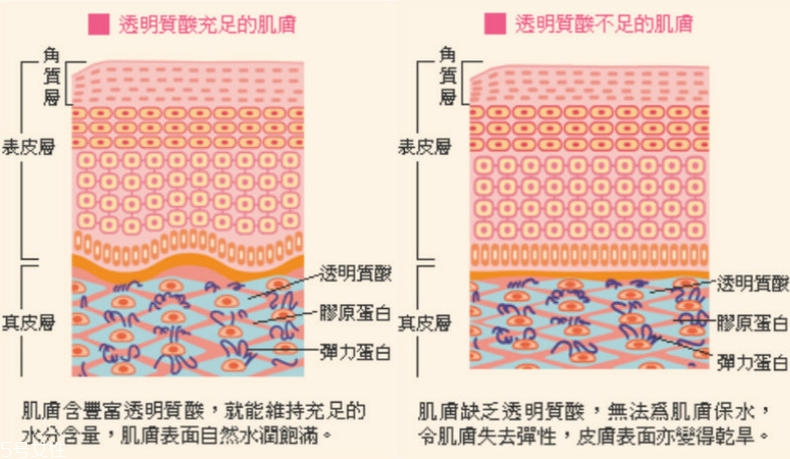 干性肌膚怎么抗皺 干性肌抗皺注意三點(diǎn)