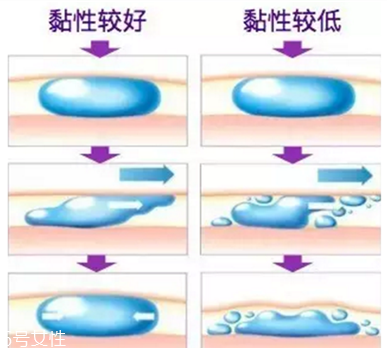 伊婉玻尿酸有幾個型號 伊婉c型和v型的區(qū)別