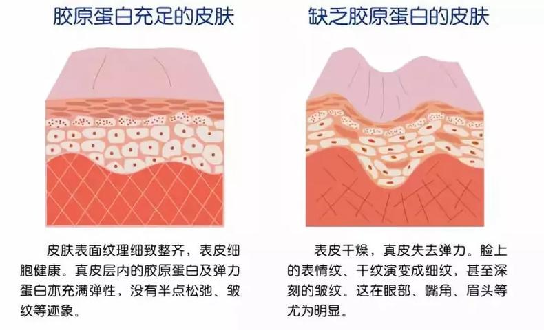 法令紋明顯什么原因 6個原因讓你少年老成