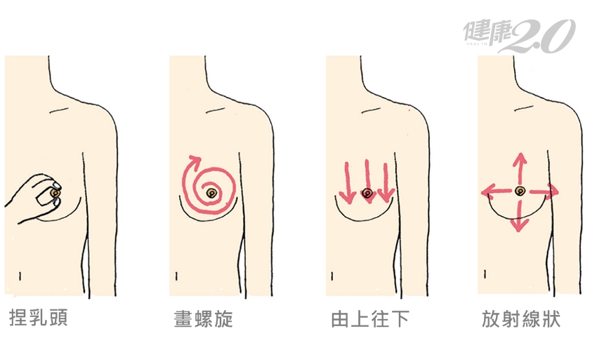 怎樣判斷乳房健康 每月3步驟自我檢查