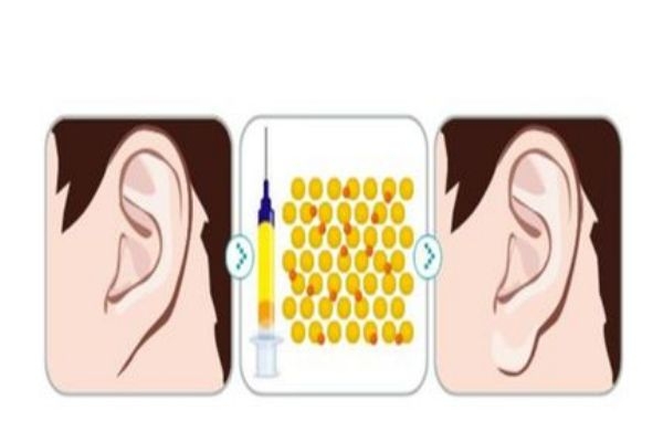豐耳垂有什么注意事項嗎 破尿酸豐耳垂有什么好處呢