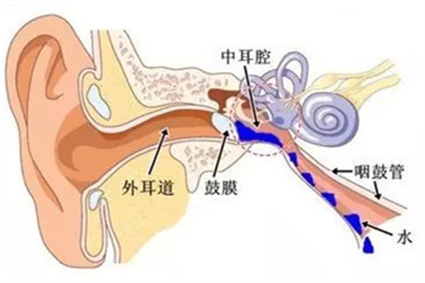 中耳炎癥狀表現(xiàn)有哪些 中耳炎是耳膜破了嗎