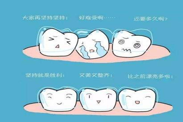 牙齒矯正會反彈嗎 牙齒矯正會改變嘴唇嗎